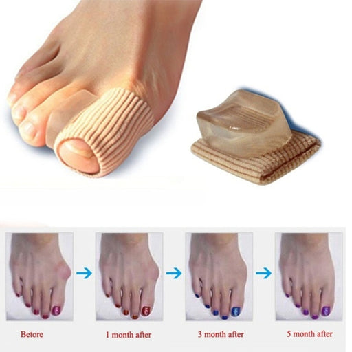 A close-up image of an Orthopedic Silicon Pad Toe Spreader being worn on a foot, showcasing its cushioning and protective capabilities.