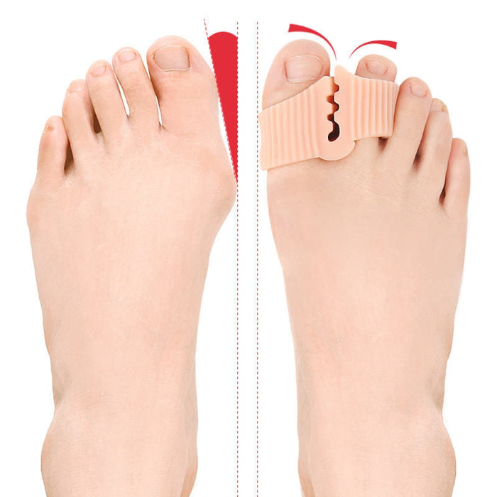 Digital Shoppy bunion correction toe separator close‑up showing ribbed gel design and flexibility