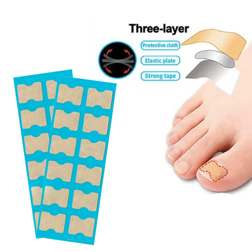 Inlay nail paste double-sided tape for nail correction and repair