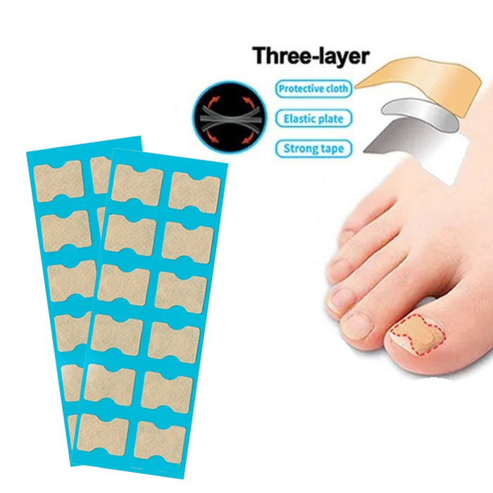 Inlay nail paste double-sided tape for nail correction and repair