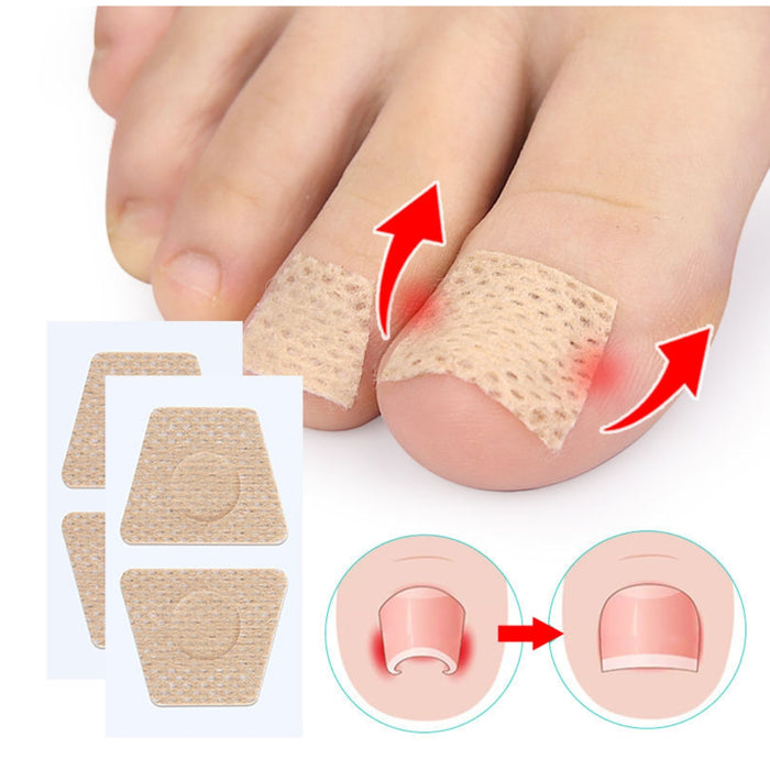 Digital Shoppy Toenail Patches Portable Mini Nail Repair Strips Nighttime Renewal Nails Sticker