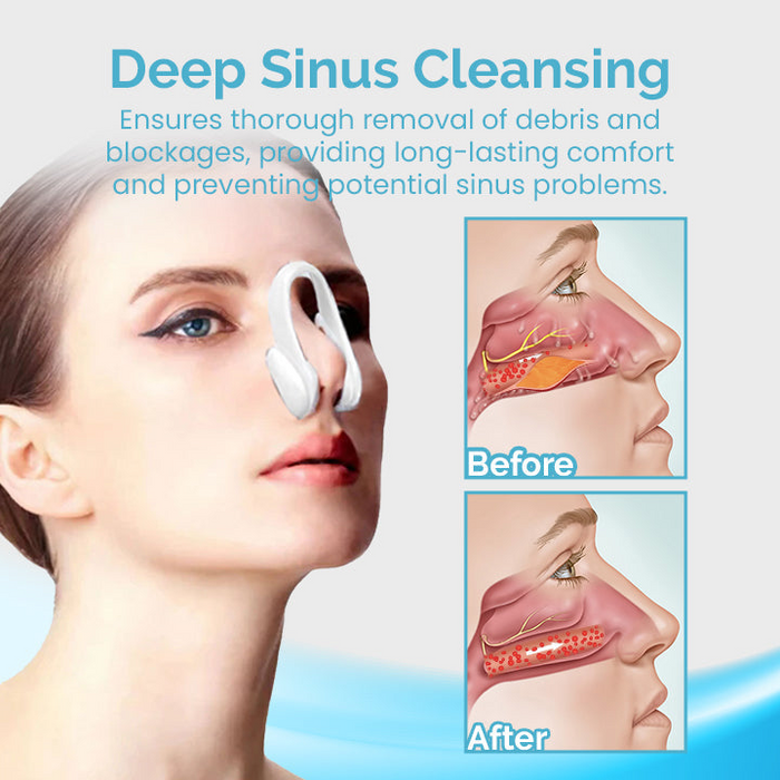 Digital Shoppy Mucus Relief Nasal Cleansing Device – A handheld nasal irrigator for sinus congestion relief.