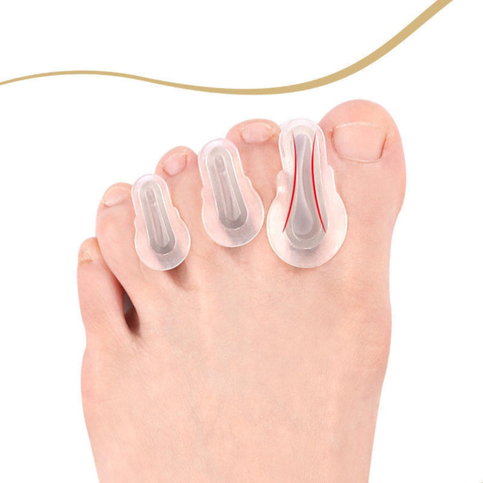Digital Shoppy  Cuttable Two Rings Foot Care Silicone SEBS Gel Big Toe Straightener Hallux Valgus Bunion Orthopedic Toe Separator