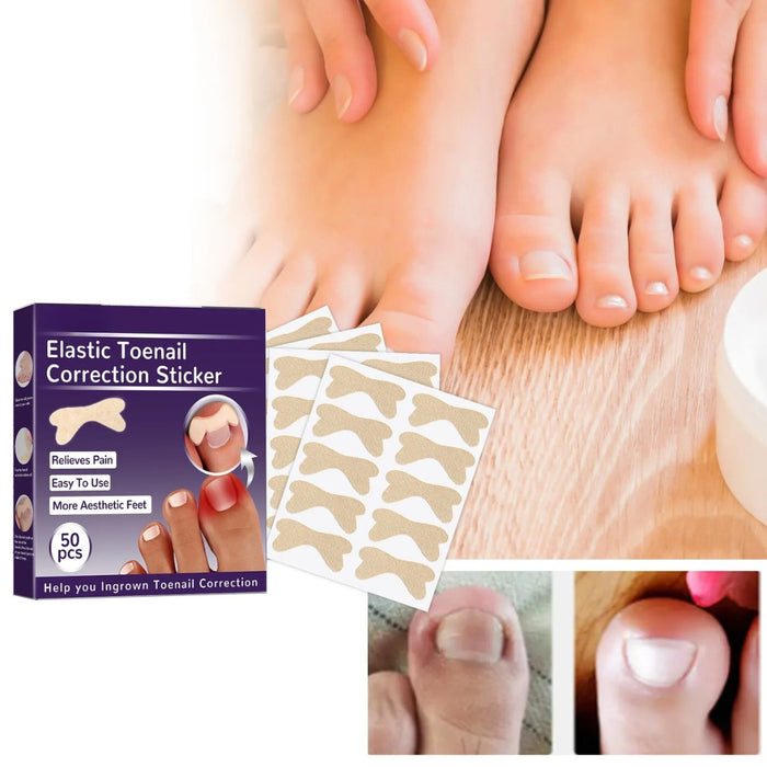 Digital Shoppy  Elastic Toenail Correction Patch ( 50 pcs )