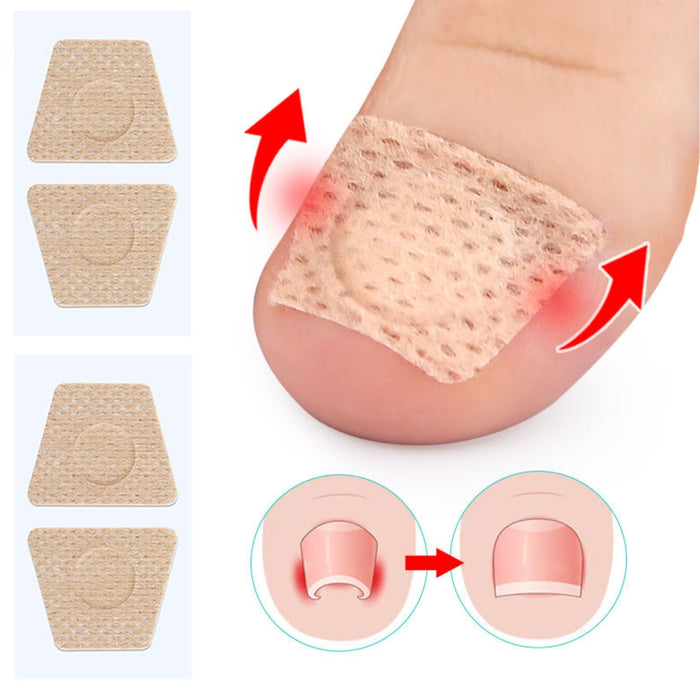 Digital Shoppy Toenail Patches Portable Mini Nail Repair Strips Nighttime Renewal Nails Sticker