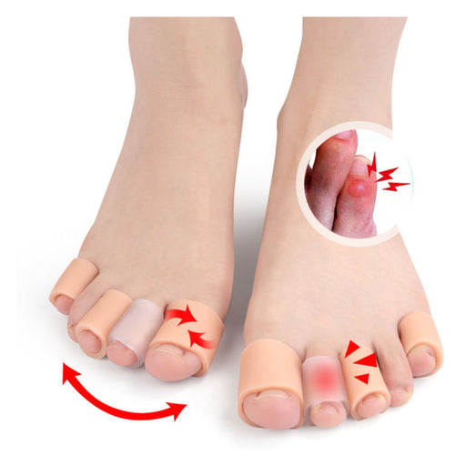 Bunion correctors on feet with a close-up of bunions and red arrows indicating movement.