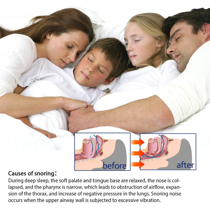 Family in bed with anatomical diagrams showing airway obstruction and snoring causes before and after relief