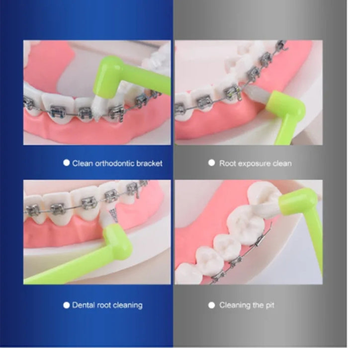 Digital Shoppy Wisdom tooth socket cleaning orthodontic toothbrush Green-2pcs