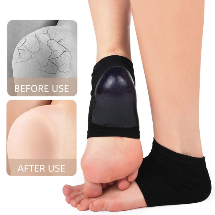 Digital Shoppy Moisturizing Heel Socks for Cracked Heel Treatment Open Toe Socks Cracked Gel Heel Socks for Women Dry Hard Cracked (black)