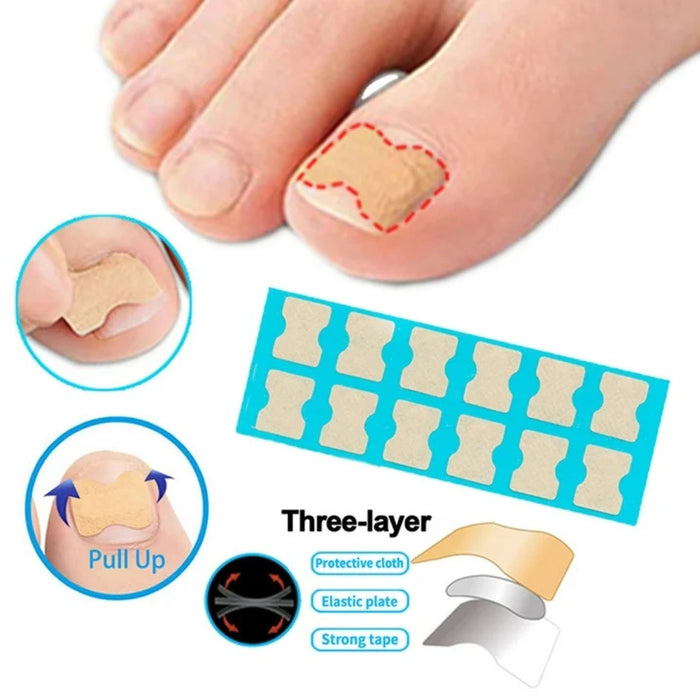 Easy-to-use inlay nail tape for shaping, repairing, and nail art design