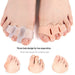 Digital Shoppy bunion correction toe separator before and after use demonstration with alignment improvement