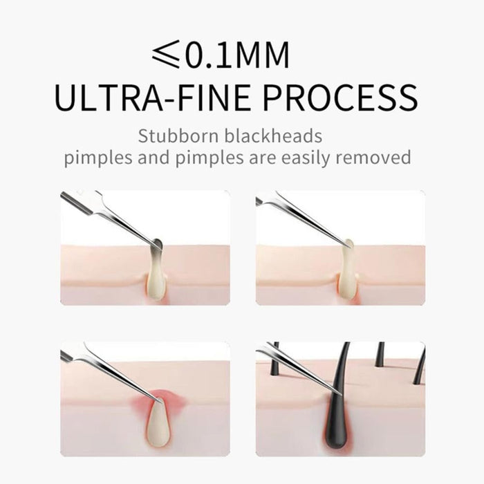 Illustration of a blackhead removal tool with text about ultra-fine process and effectiveness.