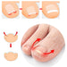Digital Shoppy ingrown toenail correction illustration showing nail lifting process with adhesive strip