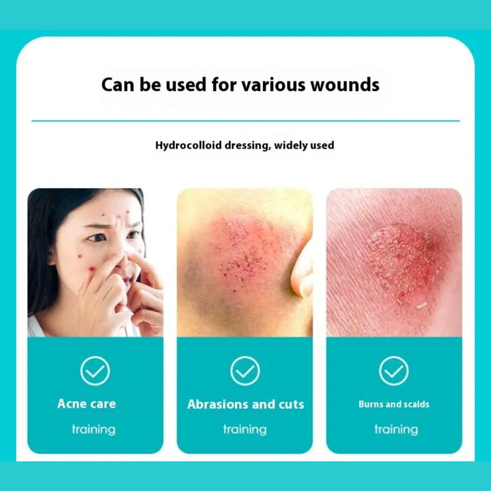 Three-panel infographic showing hydrocolloid dressing used for acne, abrasions, and burn care applications