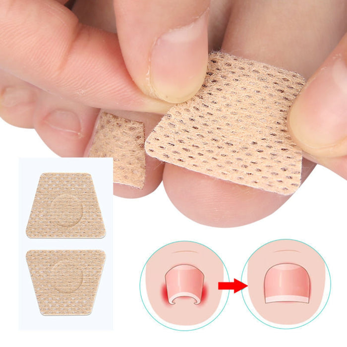 Digital Shoppy Toenail Patches Portable Mini Nail Repair Strips Nighttime Renewal Nails Sticker