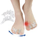 Digital Shoppy bunion correction toe separator close‑up showing ribbed gel design and flexibility
