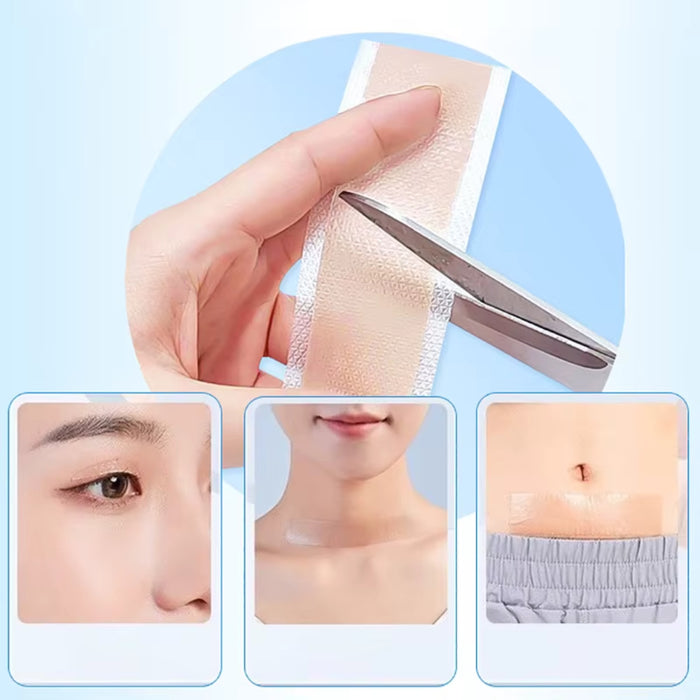Digital Shoppy Silicone Scar Tape - Professional Medical-Grade Scar Reduction Roll (4x15cm)