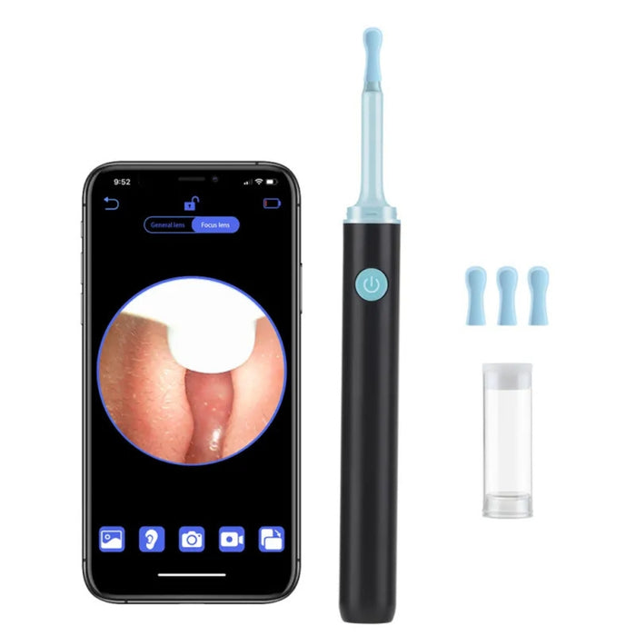 Close-up of a smartphone screen displaying a live camera feed of an inner ear canal—connected to a black Digital Shoppy visual ear scoop with a blue tip and blue power button; three interchangeable blue tips and a small transparent storage container placed nearby—illustrates real-time ear inspection using Wi-Fi-enabled endoscope – 1598453325969 12862661.