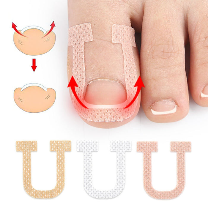 Digital Shoppy U‑shape adhesive strip applied around toenail with diagrams showing correction method