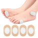 Digital Shoppy oval callus cushion pads applied to toes and side of foot with beige border