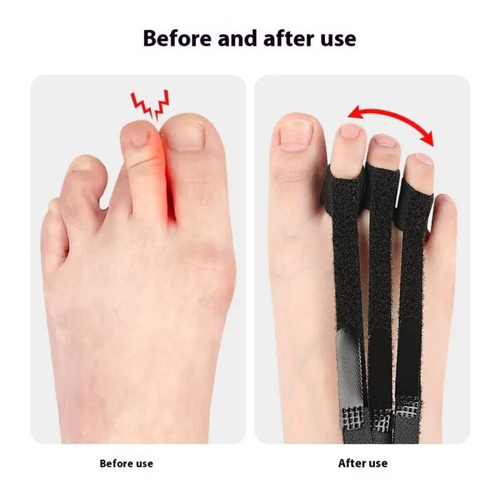Toe alignment device with bendable supports and adjustable overlap straps for comfortable foot correction and pain relief.