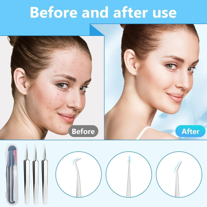 Before and after use comparison of a skincare product with a woman's face, tools, and illustrations.