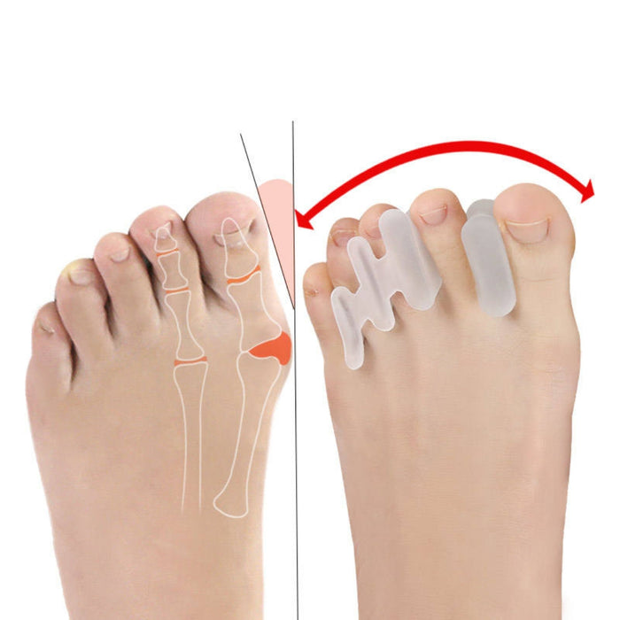 Digital Shoppy silicone toe separator used with sandals showing ergonomic fit and comfort