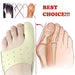 A foot with a prominent big toe, displaying a super thin orthodontic appliance intended for comfort day and night. 3851431239039