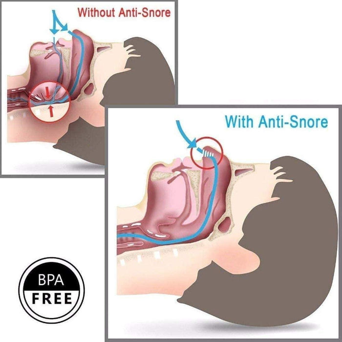 Digital Shoppy 1 Pc Anti Snoring Mouth Guard Stopper Mouthpiece Silicone &1 Pc Anti Snore Stop Snoring Nose Clip Sleep Tray Sleeping Aid--FREE SHIPPING