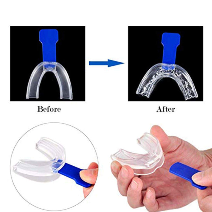 Digital Shoppy 1 Pc Anti Snoring Mouth Guard Stopper Mouthpiece Silicone &1 Pc Anti Snore Stop Snoring Nose Clip Sleep Tray Sleeping Aid--FREE SHIPPING