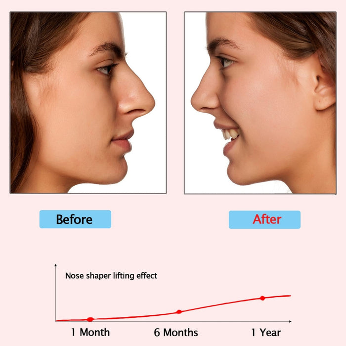 Nose Bridge Lifter – Non-Surgical Shaping Clip, Comfortable Fit, before-and-after comparison with lifting effect graph