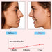 Nose Bridge Lifter – Non-Surgical Shaping Clip, Comfortable Fit, before-and-after comparison with lifting effect graph