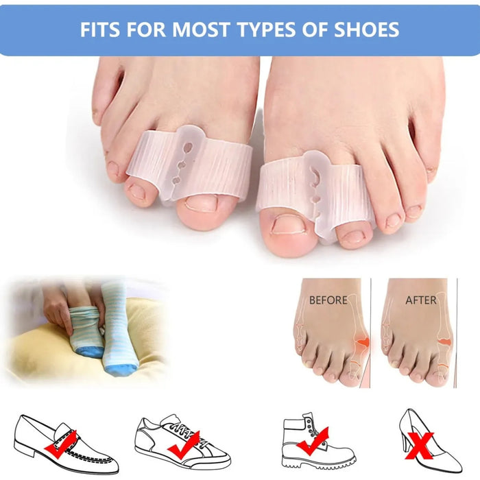 Digital Shoppy bunion corrector toe separator worn with shoes showing compatibility and alignment improvement