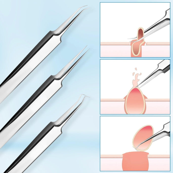Two tweezers with a blue background and inset images showing their use.