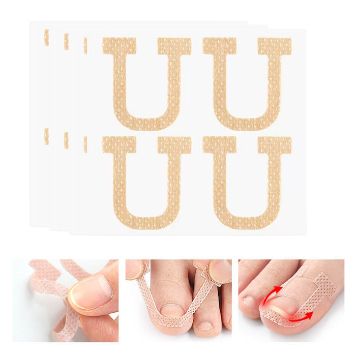 Digital Shoppy U‑shape adhesive strips beige sheet with application demo lifting toenail edges