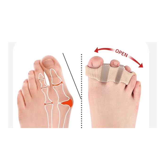 Digital Shoppy Toe Corrector for Hammer Toes, Overlapping Toes & Bunionette Pain ( 3 holes )