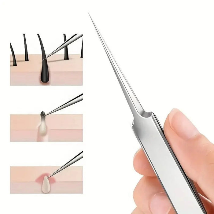 Metal tool being used on skin with close-up insets showing application process.