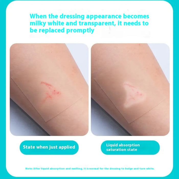 Side-by-side comparison of dressing before and after saturation, indicating when to replace for optimal healing