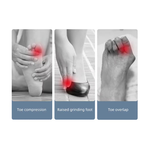 Three images showing foot issues with red highlights on toes, feet, and shoes.
