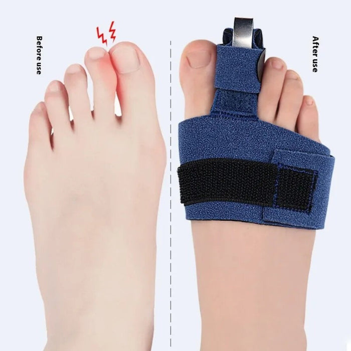 A lightweight toe splint with a curved aluminum plate, adjustable Velcro straps, and soft padding designed to immobilize and protect injured toes while allowing comfortable movement.