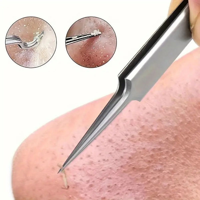 Metallic tweezer removing a hair from skin with close-up insets showing hair and skin texture.