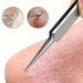 Metallic tweezer removing a hair from skin with close-up insets showing hair and skin texture.