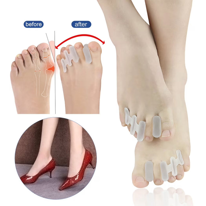 Digital Shoppy orthotic toe separator worn with shoes showing compatibility and alignment improvement