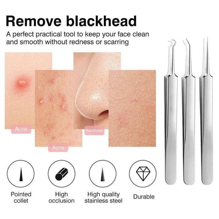 Blackhead removal tool set with images of skin conditions and tool features.