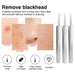 Blackhead removal tool set with images of skin conditions and tool features.