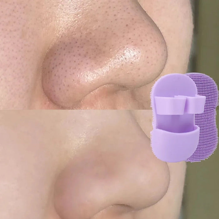 Purple silicone face scrubber shown with nose before-and-after – visibly reduced blackheads and smoother skin after cleansing – gentle exfoliation – 860000022226113652836