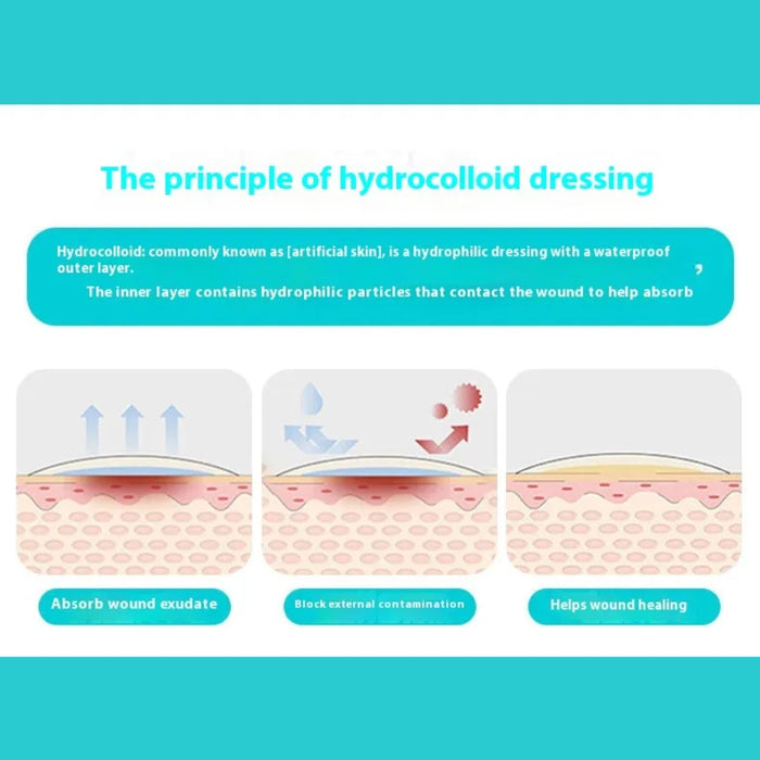 Hydrocolloid dressing principle diagram showing fluid absorption, contamination blocking, and healing support