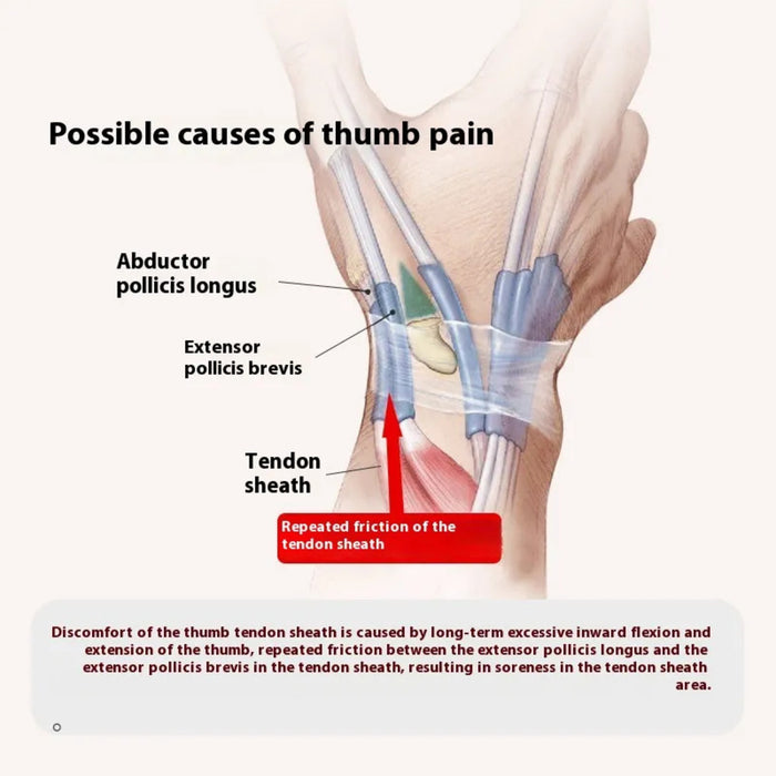 "Close-up of a black finger holder protective sleeve designed for thumb support and injury recovery. Features breathable fabric and adjustable straps for a secure fit, ideal for arthritis relief and sports protection."-