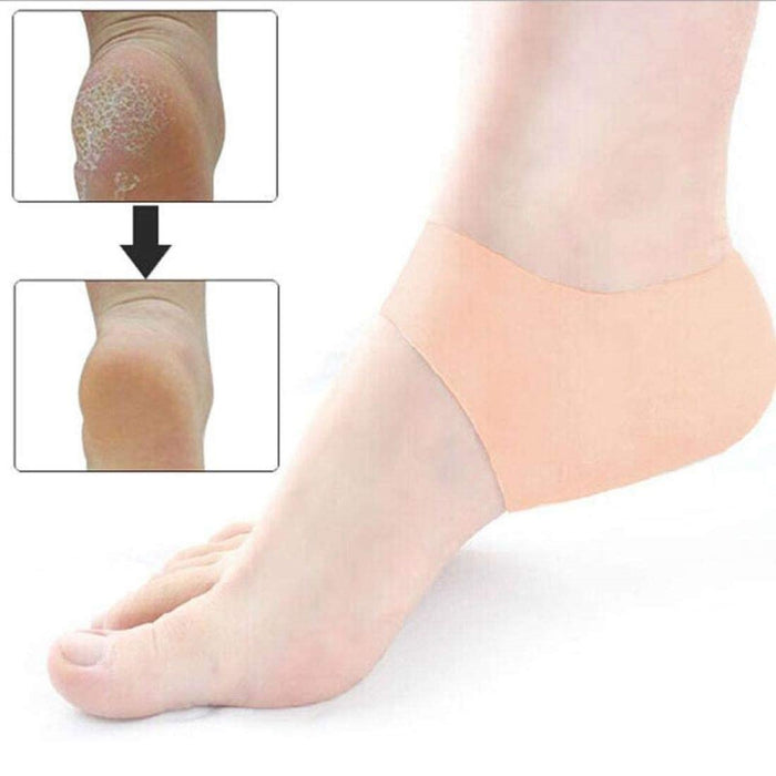 Digital Shoppy Foot Care Products Medical Cracked Silicone Care Heel Cover Cushion Anti-slip Maintenance Foot Heel Protect Feet Care 1Pair(skin colour)