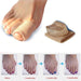 Digital Shoppy 1 Pc Health Orthopedics Bunions Foot Care Pedicure Silicone Pad Protection Toe Separate Hallux Valgus Foot Care Tools